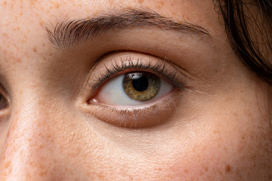 Habit Hack: How to Minimise Dark Circles and Puffiness