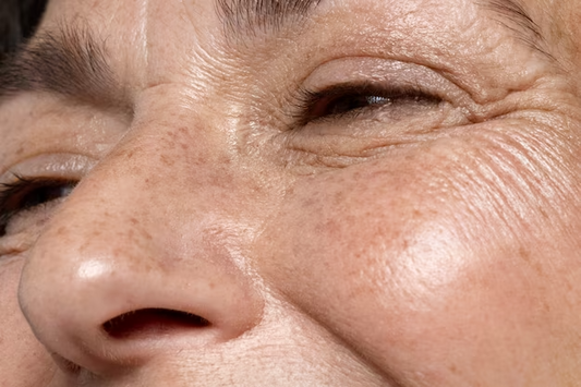 Habit Hack: Dehydrated Lines vs. Wrinkles: What's The Difference?