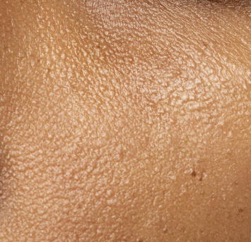 Even tone skin